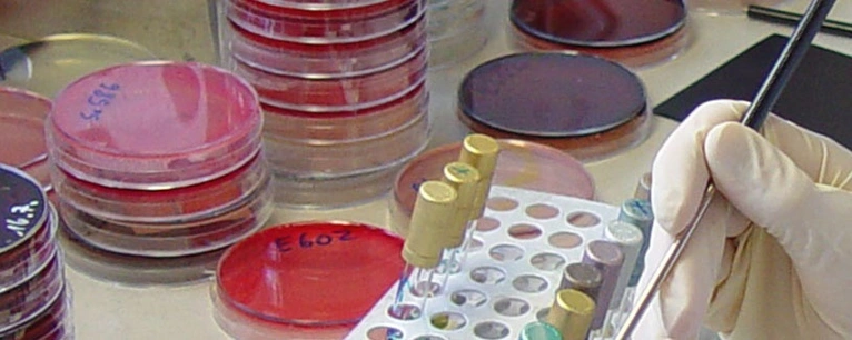 Aids, HIV, Infektion — © Symbolfoto - Arbeiten im Analyse- und Diagnostikzentrum - Bild: Landesamt für Gesundheit
